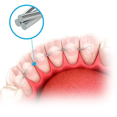 Contenedor TwistForm